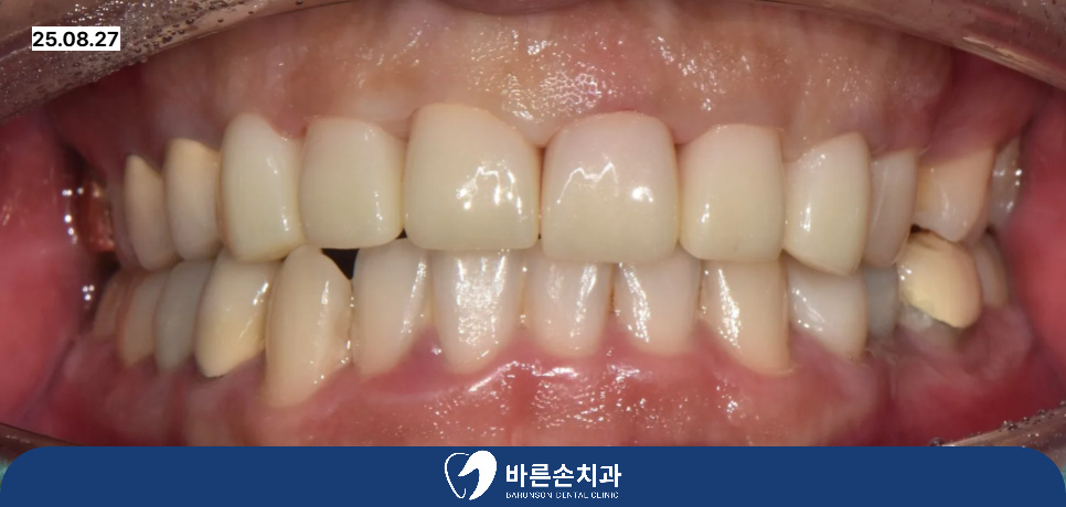 발곡역치과