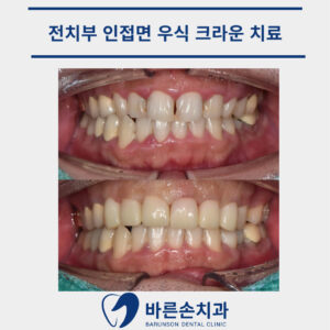 발곡역치과