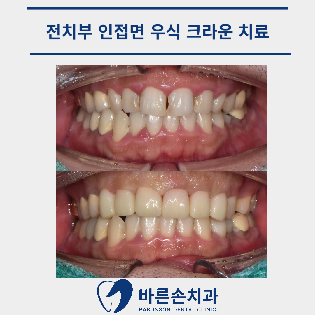 발곡역치과